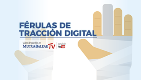 im_ferulas-trac-digital_n1.png